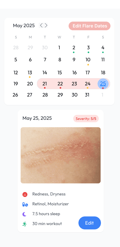 Flare calendar screen